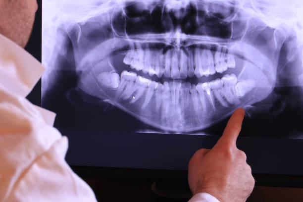Best Emergency Gum Treatment in Pittsfield, IL