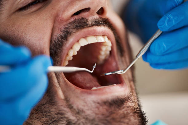 Best Emergency Root Canal Treatment in Pittsfield, IL